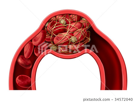 Blood Clot Disease Symbol 34572040