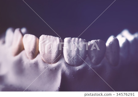 Dental Prosthesis Prosthetic Laboratory 34576291