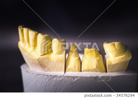 Dental Prosthesis Prosthetic Laboratory Dental Prosthesis Prosthetic Laboratory 34576294