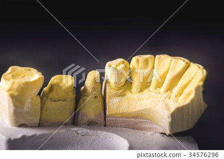 Dental Prosthesis Prosthetic Laboratory Dental Prosthesis Prosthetic Laboratory 34576296