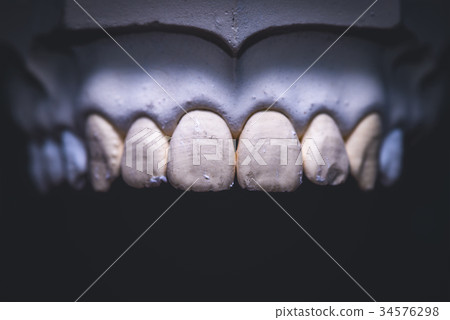 Dental Prosthesis Prosthetic Laboratory 34576298