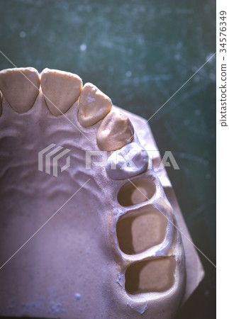 Dental Prosthesis Prosthetic Laboratory 34576349
