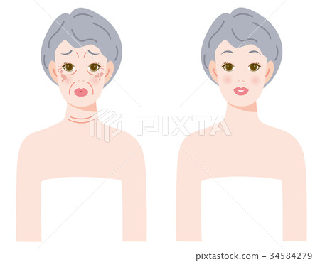 Aging Simi Before After 34584279