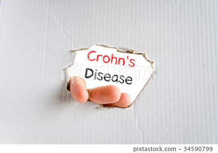 Crohn's disease text concept Crohn's disease text concept 34590799