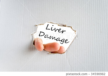 Liver damage text concept 34590982