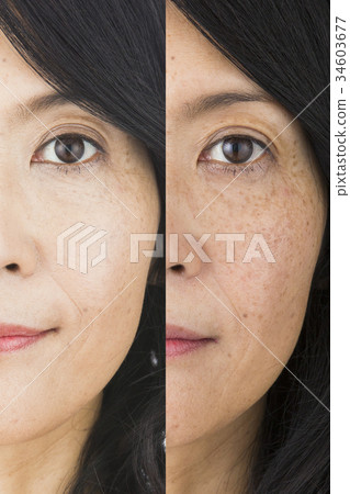 Before after image Before after image 34603677