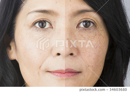 Before after image 34603680