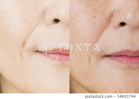 之前的圖像 34603744