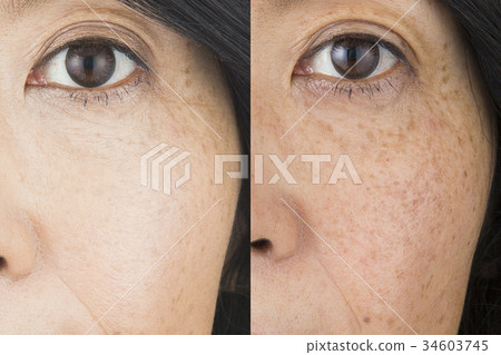 之前的圖像 34603745