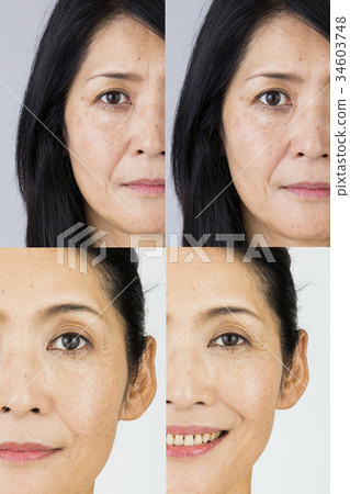 Before after image 34603748