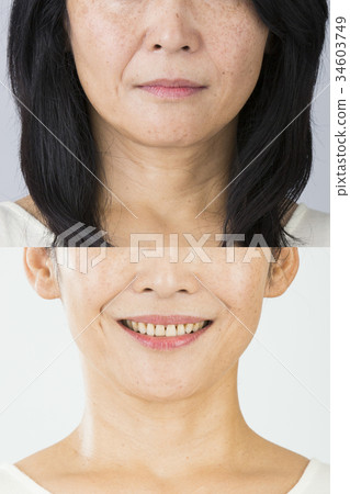Before after image 34603749