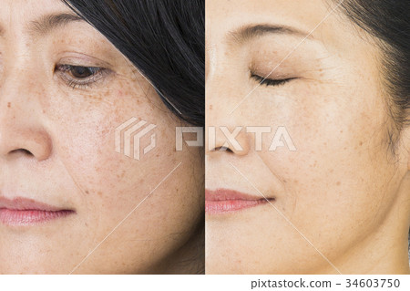 Before after image Before after image 34603750