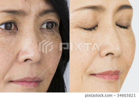 Before after image 34603821