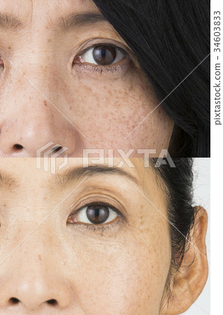 Before after image 34603833