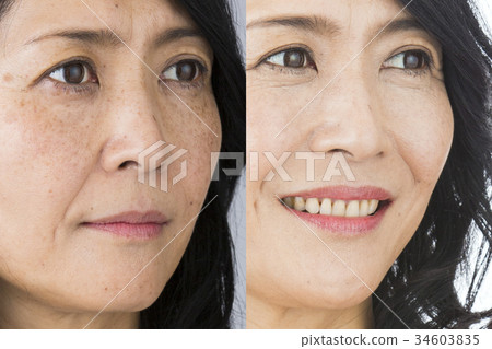 Before after image 34603835