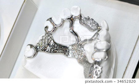 example of a bridge on an artificial human jaw example of a bridge on an artificial human jaw 34652820