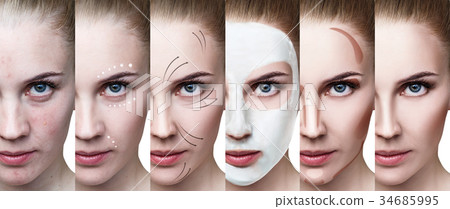 Woman step by step improves her skin condition. Woman step by step improves her skin condition. 34685995