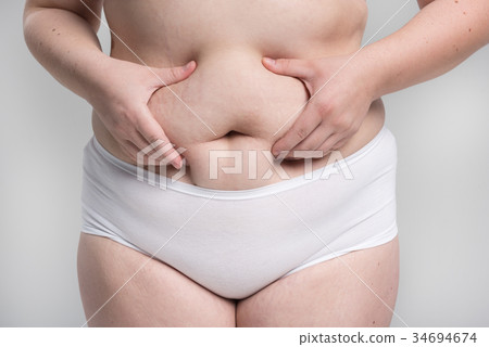 Fat lady showing her large belly 34694674