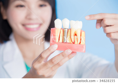 woman dentist take implant tooth woman dentist take implant tooth 34828155