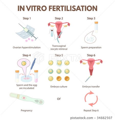 In vitro fertilization 34882507