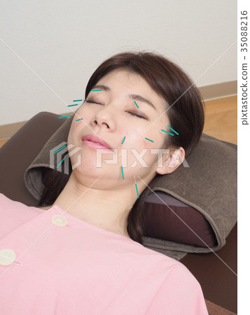 Woman doing beauty acupuncture 35088216