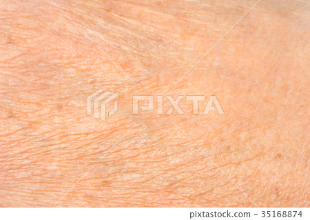 Texture of the skin 35168874