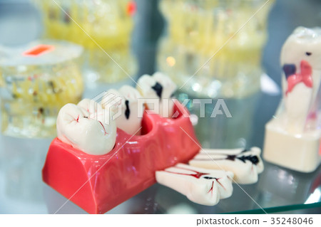 Denture treatment, prosthetic dentistry, medicine Denture treatment, prosthetic dentistry, medicine 35248046