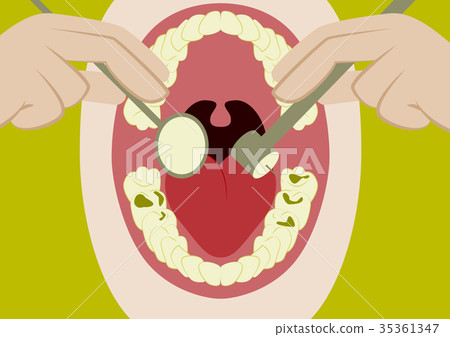 Vector illustration in flat design oral cavity and Vector illustration in flat design oral cavity and 35361347