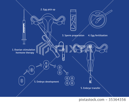 Concept In Vitro Fertilization Thin Line White Concept In Vitro Fertilization Thin Line White 35364356