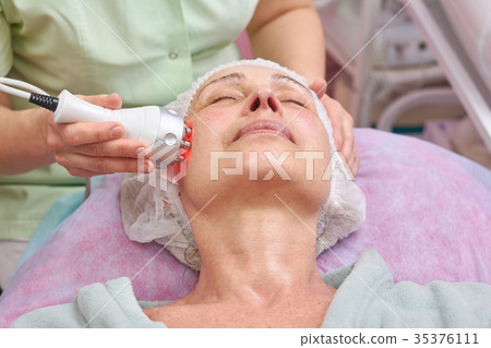 Adult woman, rf skin tightening. Adult woman, rf skin tightening. 35376111