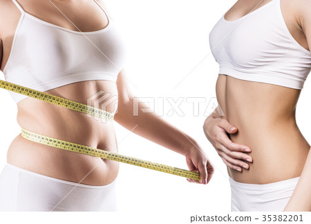 Woman's body before and after weight loss. 35382201