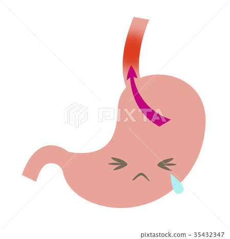 Reflux esophagitis 35432347