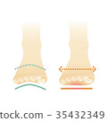 Open foot 35432349