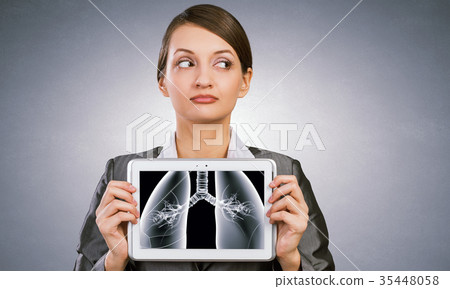 X-ray of lungs X-ray of lungs 35448058