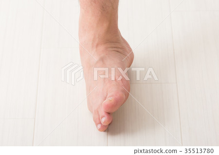 男腳 男腳 35513780