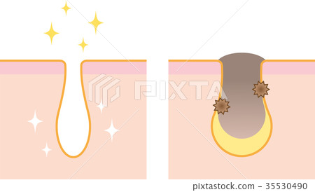 Pore Before After 35530490