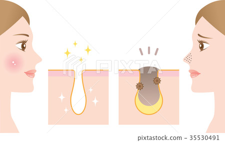 Pore Before After Pore Before After 35530491