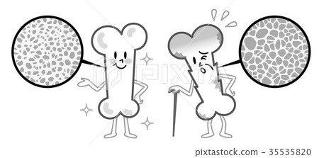 骨頭密度骨質疏鬆症黑白例證 骨頭密度骨質疏鬆症黑白例證 35535820