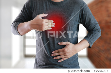 MAN with symptomatic acid reflux ,  35536005