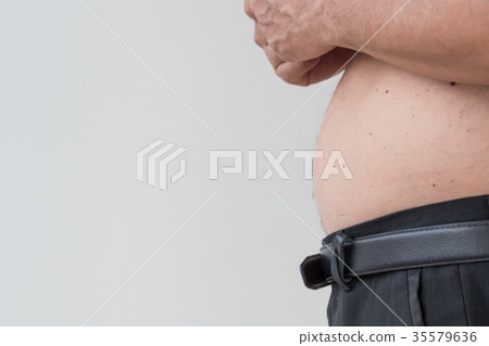 fat man belly, overweight, unhealthy lifestyle 35579636