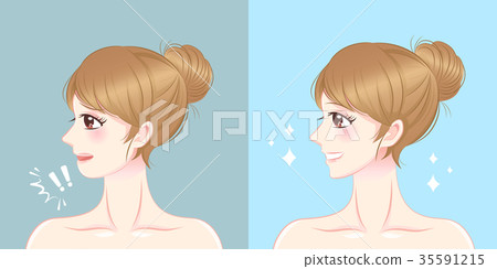 woman with chin surgery 35591215