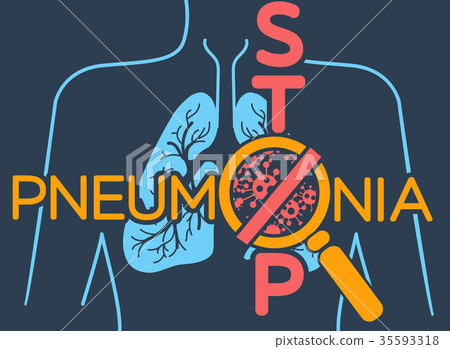 poster pneumonia - Stock Illustration [35593318] - PIXTA