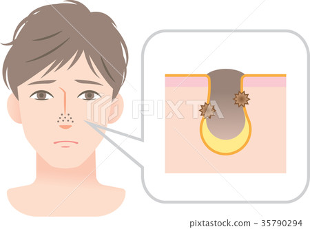 Male Skin Care Nose Male Skin Care Nose 35790294