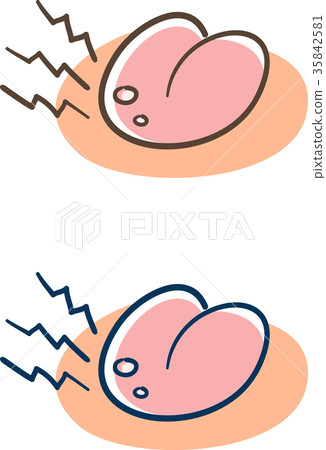 Tongue of canker sores Tongue of canker sores 35842581