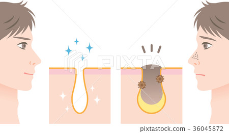 男性護膚毛孔 36045872