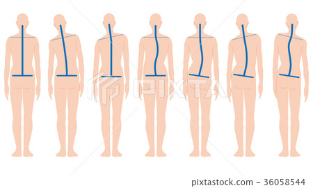 背部姿勢 36058544