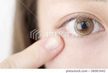 eye 36063442