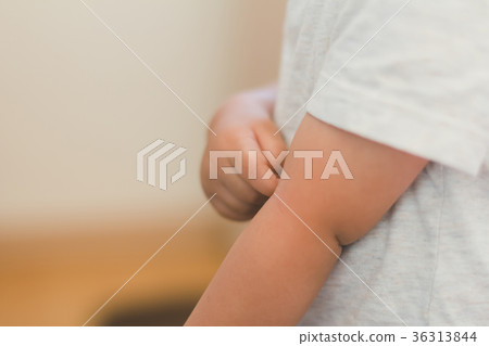 itchy, arm, arms 36313844