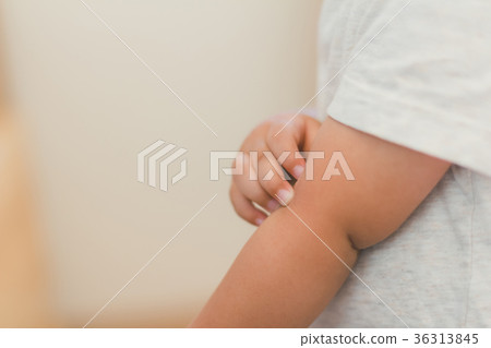 itchy, arm, arms 36313845