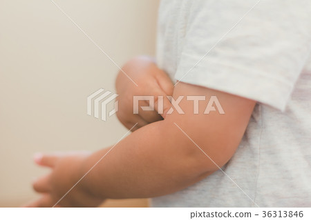 itchy, arm, arms 36313846